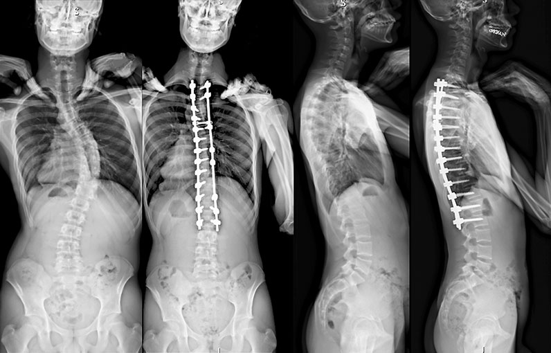 Spinal Surgeon Reports